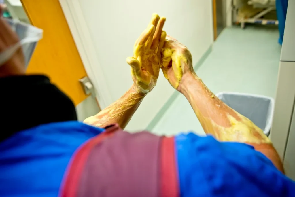 🧼 Cerrahi El Yıkama Nedir? Aşamaları, Maddeleri ve Steril El Yıkama Tekniği